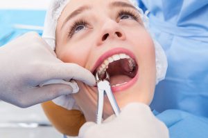 В каких ситуациях следует удалять зуб?