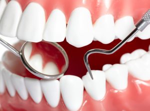 Инновационные подходы в лечении зубов: современные технологии и методы