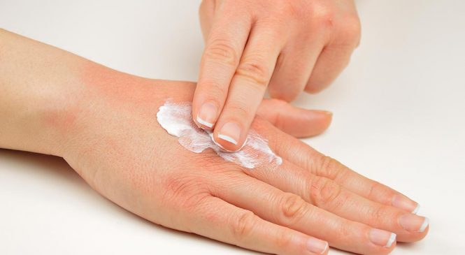 Псориаз — причины, лечение и уход за больной кожей